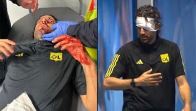 إصابة فابيو جروسو الخطيرة قبل مواجهة مارسيليا وليون (غيتي)